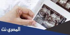 في اي شهر يمكن معرفة نوع الجنين بالسونار