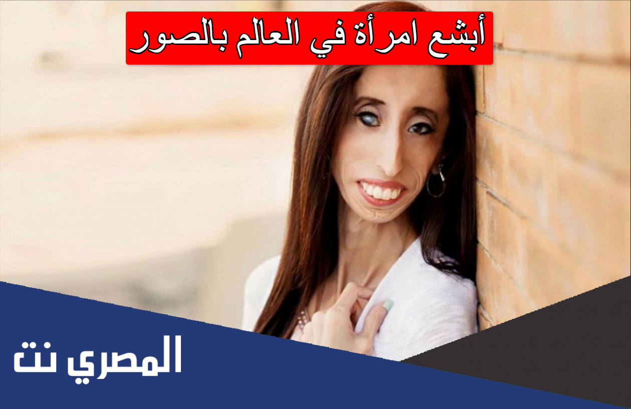 أبشع امرأة في العالم بالصور