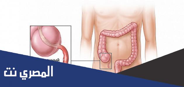 اين تقع الزائدة الدودية ؟