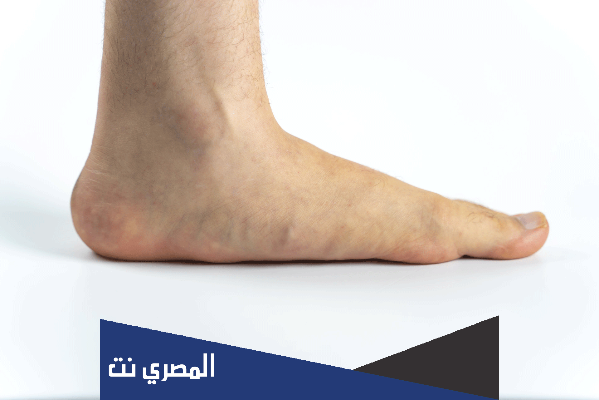 اخمص القدم ما هو ؟