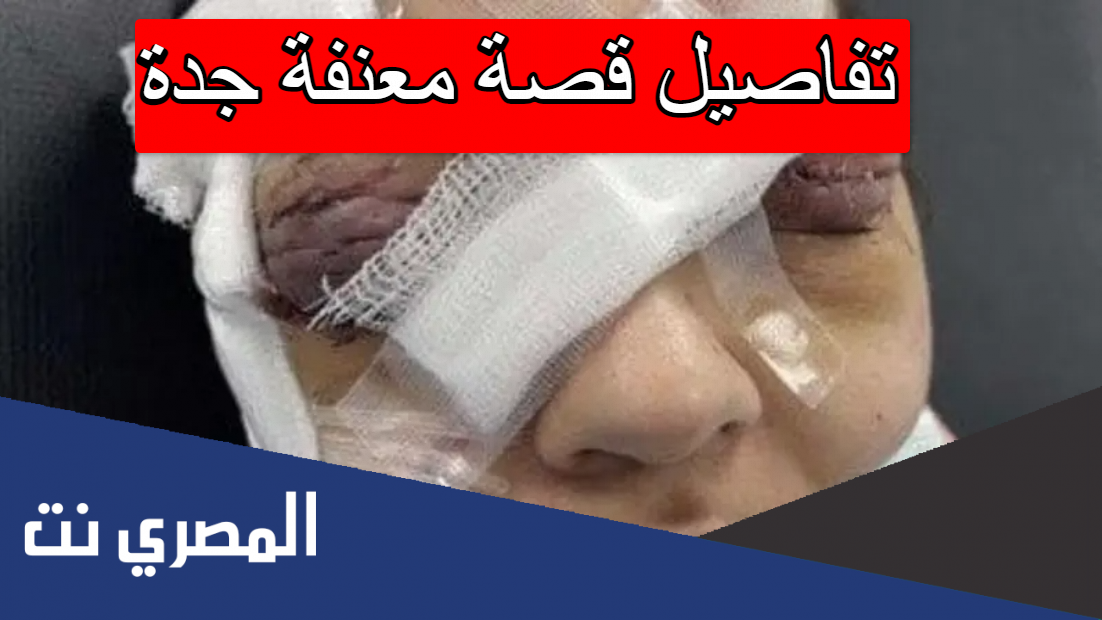 تفاصيل قصة معنفة جدة