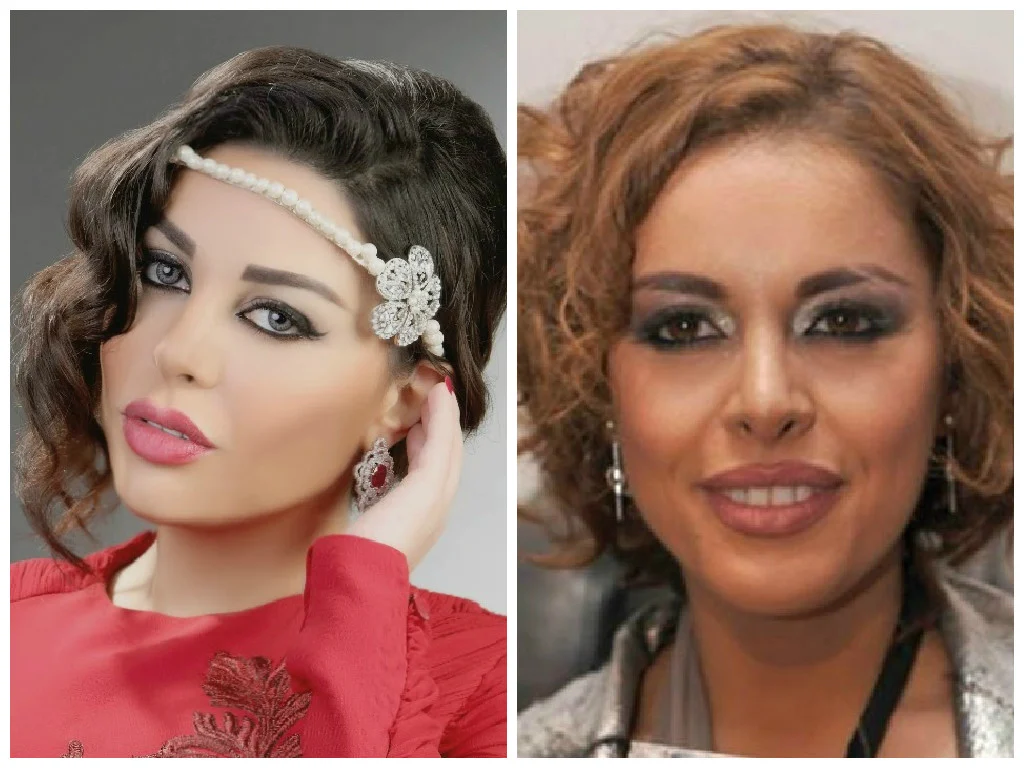 صور سارة الهاني قبل وبعد