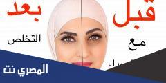 كيف اتخلص من الهالات السوداء