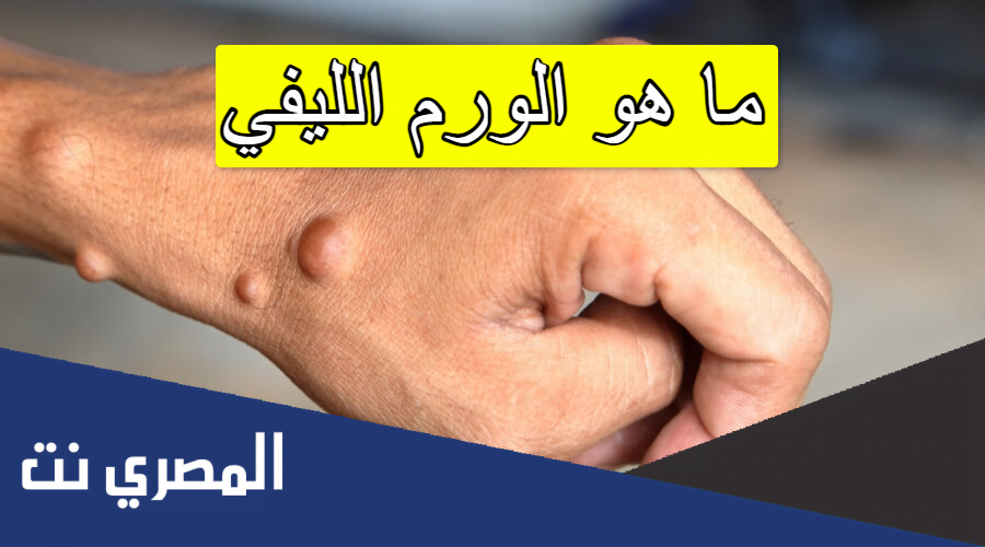 ما هو الورم الليفي