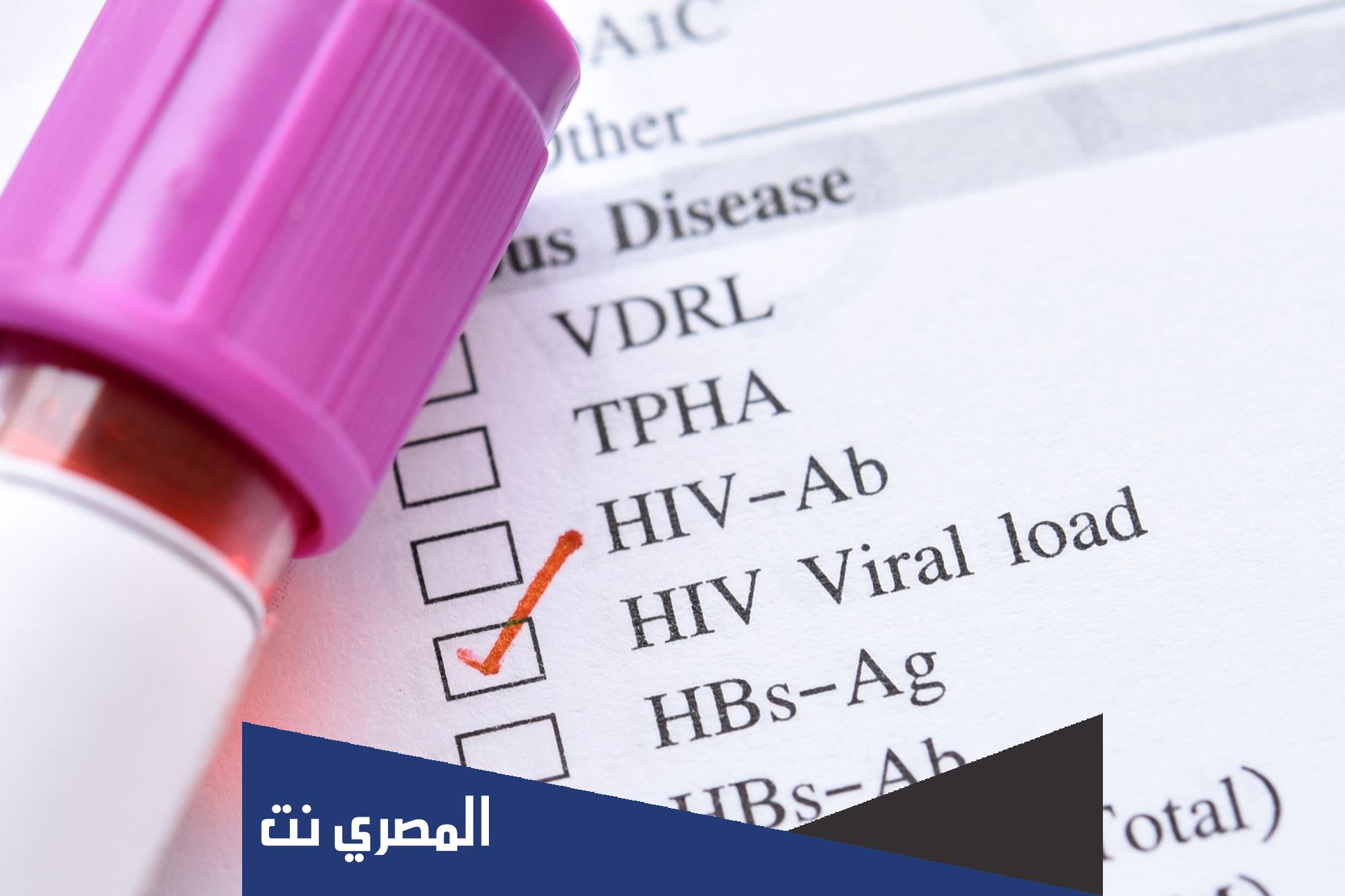 ما هو تحليل HIV AB للحامل