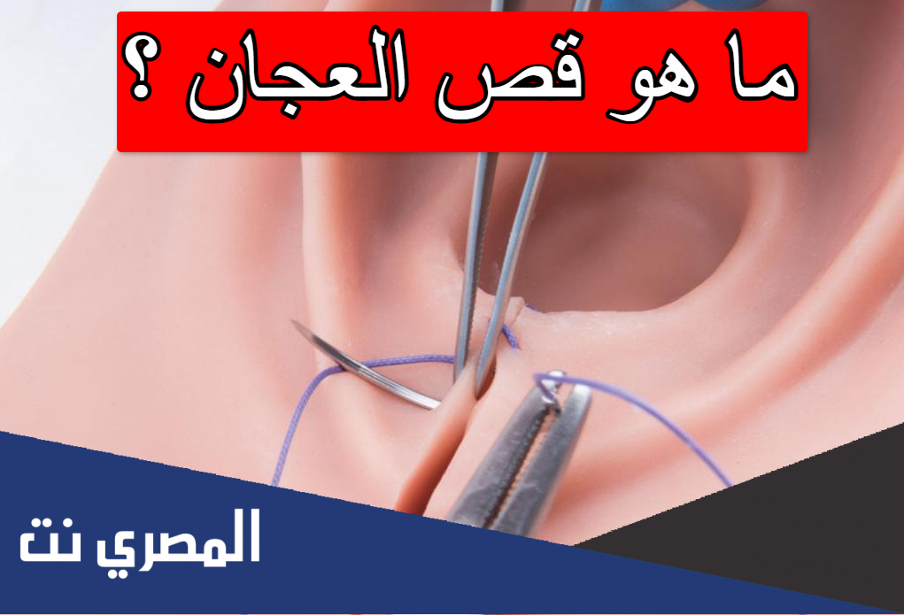 ما هو قص العجان