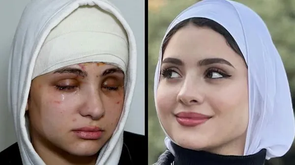 صور البلوجر ساره محمد بعد أن فقدت بصرها