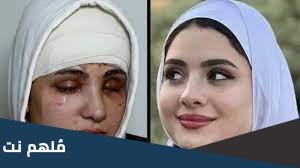 قصة البلوجر سارة محمد التي فقدت بصرها