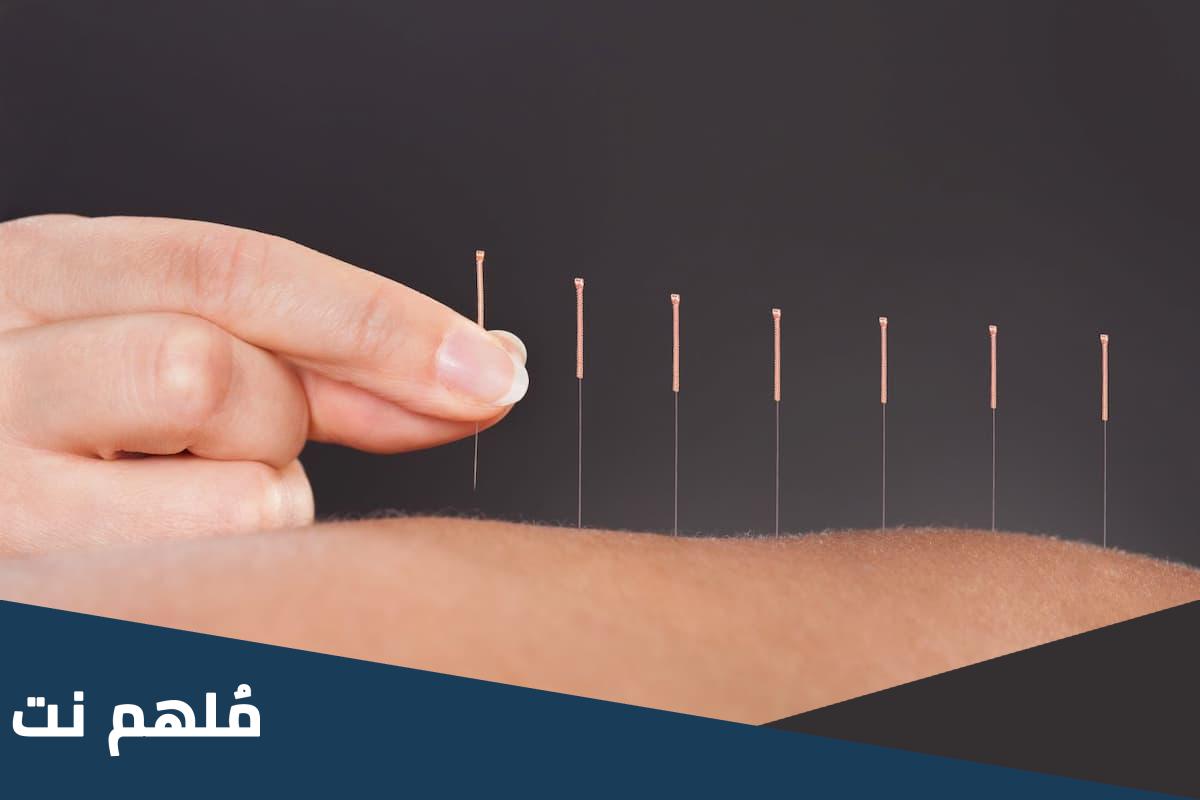 حقيقة ظاهرة الوخز بالإبر في البليدة