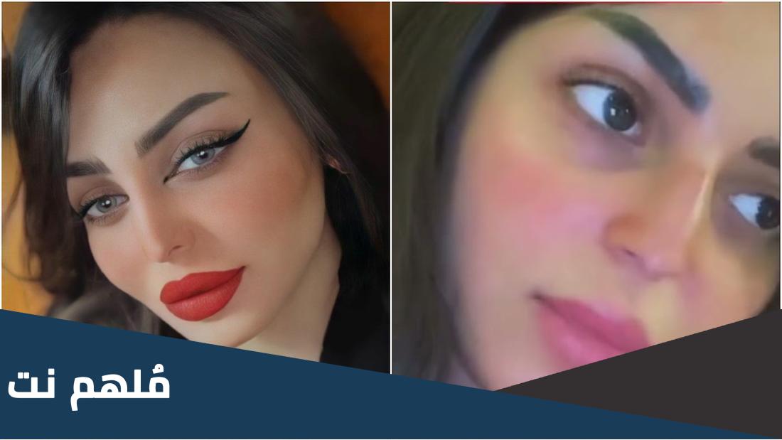 بالصور: رهف القحطاني قبل وبعد