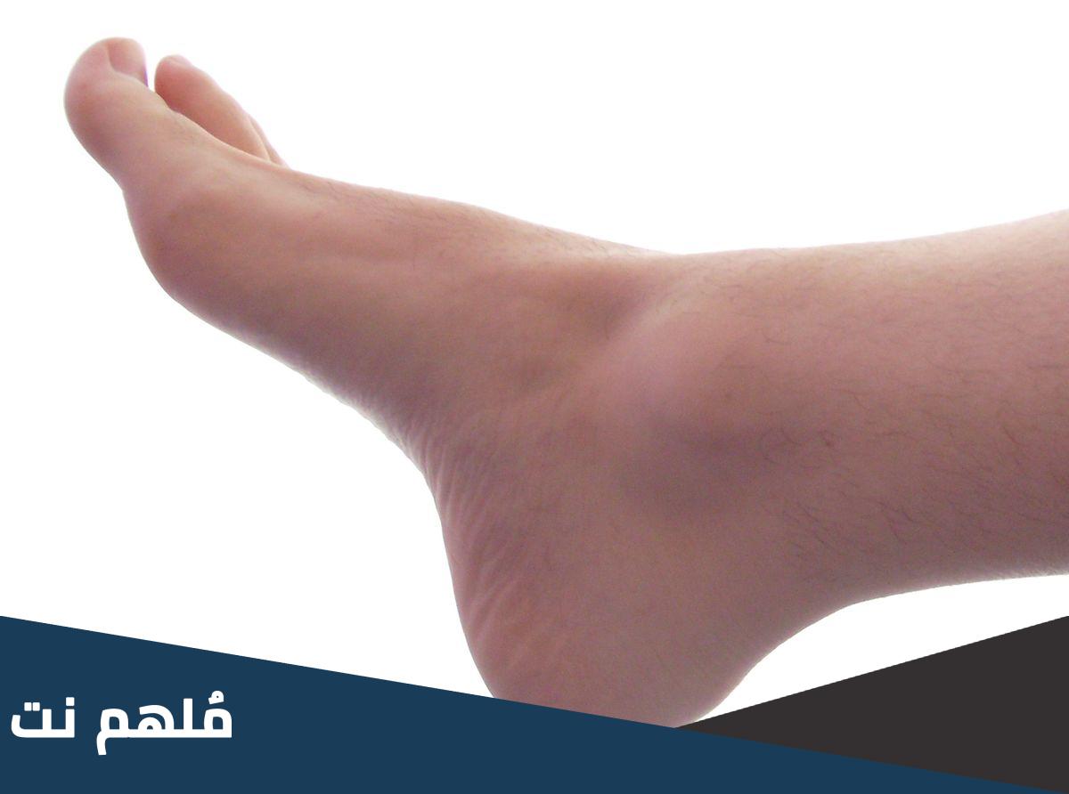 وتر غليظ فوق عقب الانسان