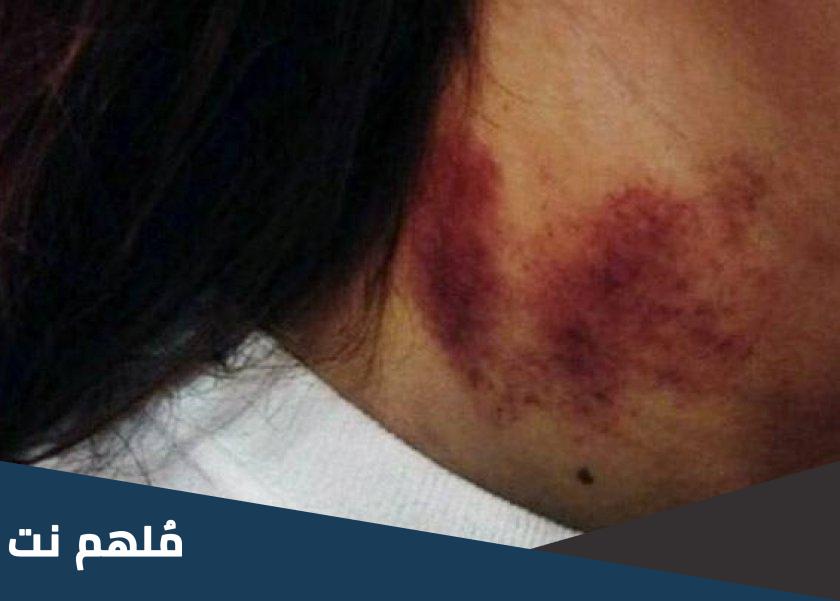 ما هي اللاف بايتس ومعناها