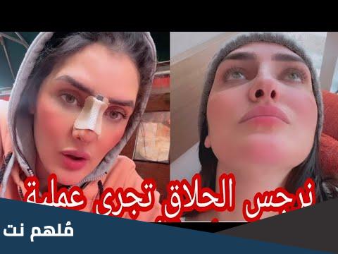 نرجس الحلاق قبل التجميل