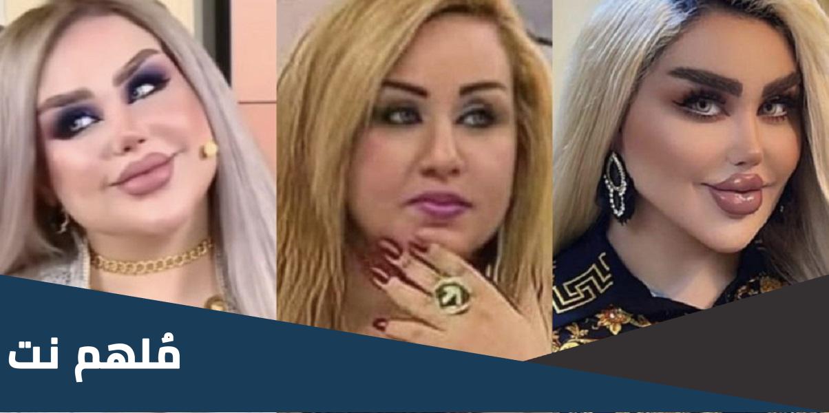 داليا نعيم قبل التجميل