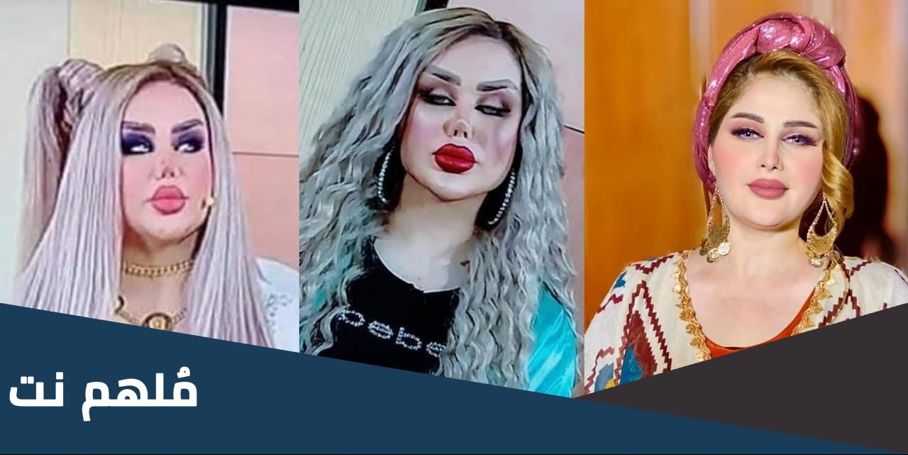 داليا نعيم قبل وبعد