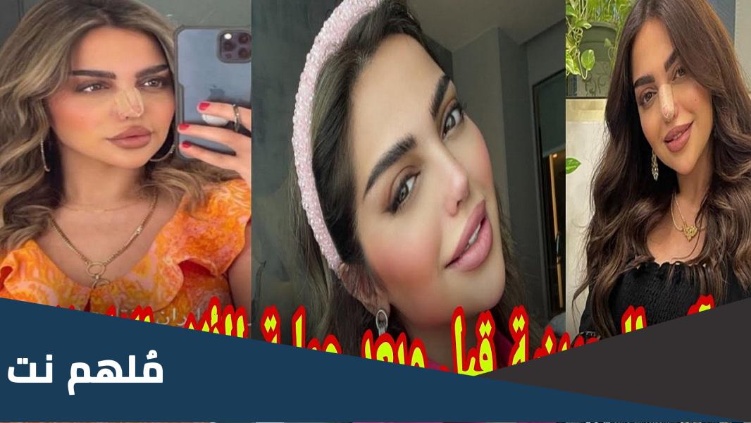 صور البلوقر آلاء البحرينية بعد عملية التجميل في الانف