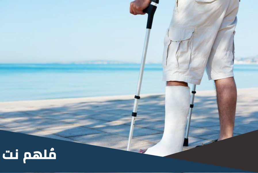 هل يمكن المشي على الرجل المكسورة؟