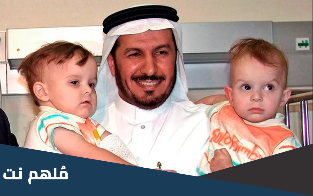 طبيب سعودي برع في فصل التوائم، من هو