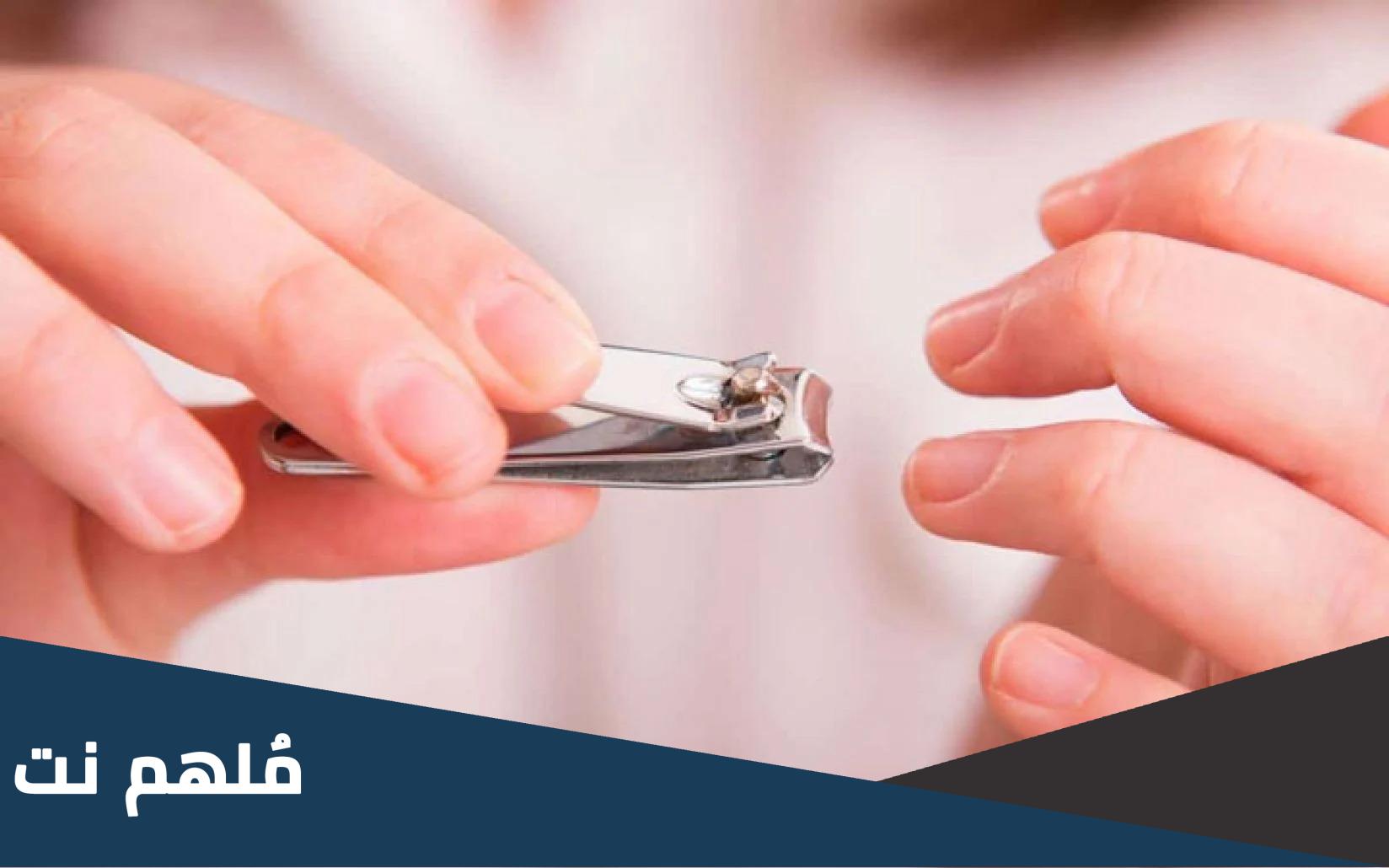 لماذا لا يجوز حلق الشعر للمضحي