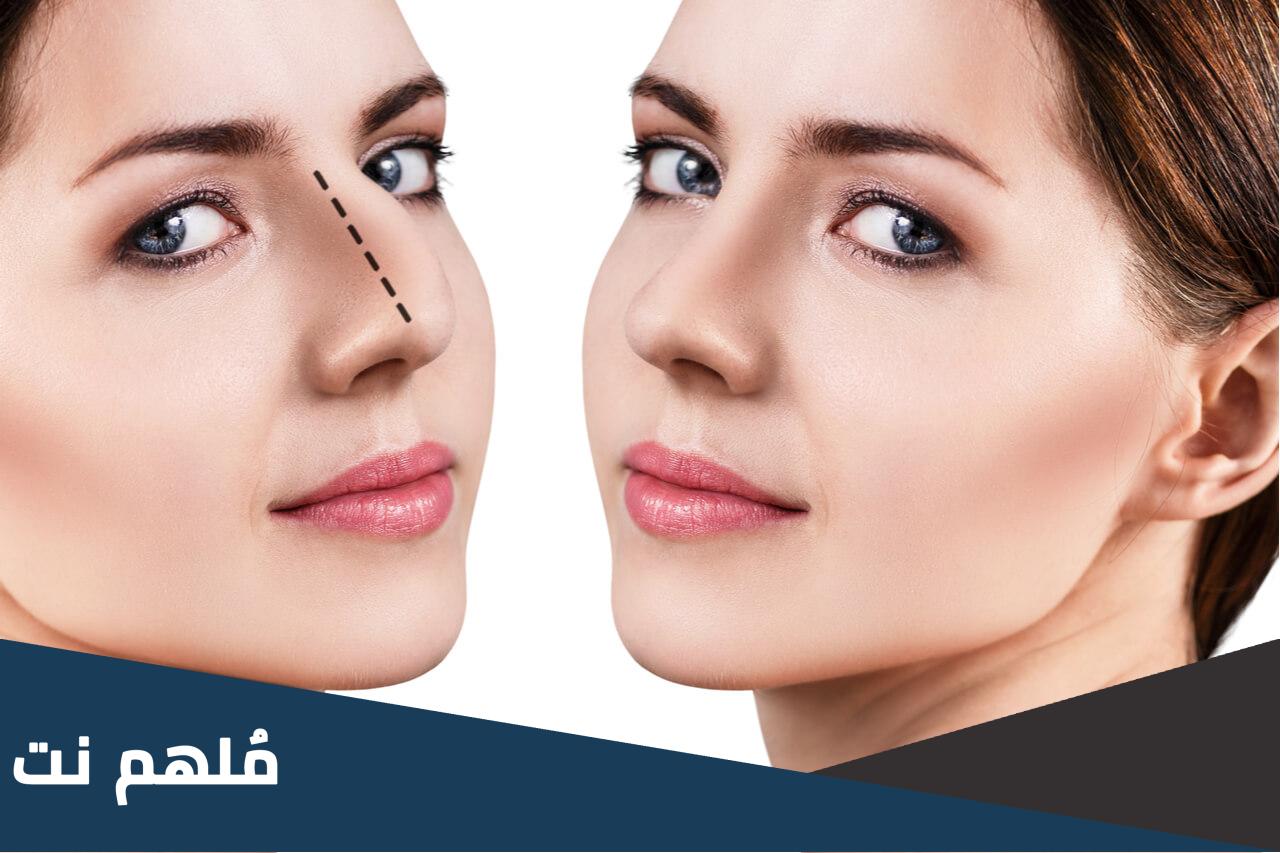 كم تكلفة عملية تجميل الأنف في السعودية