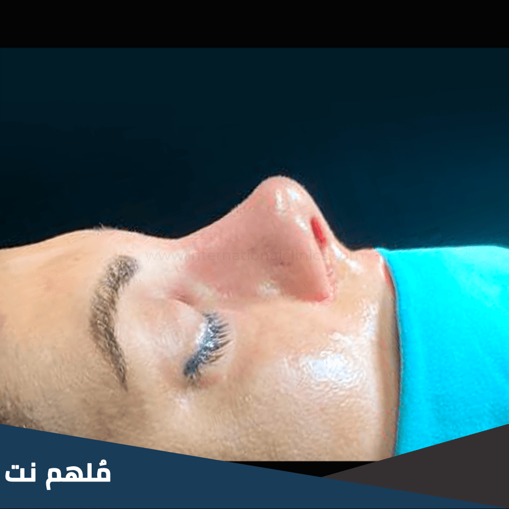 كم سعر خشم الانسان